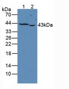 PTPRJ / CD148 Antibody - Western Blot; Sample: Lane1: Human K562 Cells; Lane2: Human Jurkat Cells.