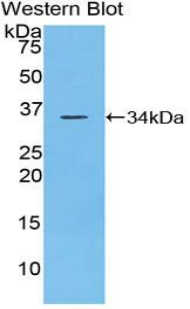 PTPRJ / CD148 Antibody - Western blot of PTPRJ / CD148 antibody.