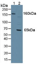 PTPRJ / CD148 Antibody - Western Blot; Sample: Lane1: Mouse Serum; Lane2: Human Jurkat Cells.