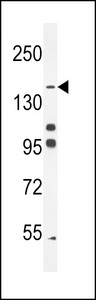 PTPRJ / CD148 Antibody - His6-DEP-1 western blot of K562 cell line lysates (35 ug/lane). The DEP-1 antibody detected the DEP-1 protein (arrow).