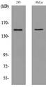 PTPRJ / CD148 Antibody - Western blot analysis of lysate from 293, HeLa cells, using PTPRJ Antibody.