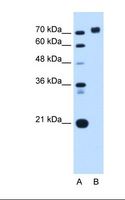 PTPRN / IA-2 Antibody - Lane A: Marker. Lane B: HepG2 cell lysate. Antibody concentration: 0.0625 ug/ml. Gel concentration: 12%.  This image was taken for the unconjugated form of this product. Other forms have not been tested.