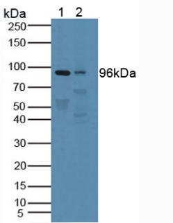 PTPRN / IA-2 Antibody - Western Blot; Sample: Lane1: Human Blood Cells; Lane2: Rat Brain Tissue.