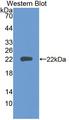 PTPRN / IA-2 Antibody - Western blot of PTPRN / IA-2 antibody.