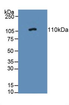 PTPRN / IA-2 Antibody - Western Blot; Sample: Rat Adrenal Gland Tissue.