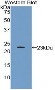 PTPRN / IA-2 Antibody - Western blot of recombinant PTPRN / IA-2.  This image was taken for the unconjugated form of this product. Other forms have not been tested.