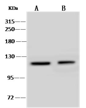 PTPRN / IA-2 Antibody - Anti-PTPRN rabbit polyclonal antibody at 1:500 dilution. Lane A: Jurkat Whole Cell Lysate. Lane B: U-251 MG Whole Cell Lysate. Lysates/proteins at 30 ug per lane. Secondary: Goat Anti-Rabbit IgG (H+L)/HRP at 1/10000 dilution. Developed using the ECL technique. Performed under reducing conditions. Predicted band size: 106 kDa. Observed band size: 120 kDa.