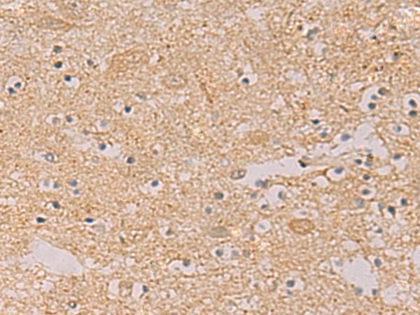 PTPRN / IA-2 Antibody - Immunohistochemistry of paraffin-embedded Human brain tissue  using PTPRN Polyclonal Antibody at dilution of 1:55(×200)