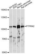 PTPRN2 / Phogrin Antibody - Western blot analysis of extracts of various cell lines, using PTPRN2 antibody at 1:1000 dilution. The secondary antibody used was an HRP Goat Anti-Rabbit IgG (H+L) at 1:10000 dilution. Lysates were loaded 25ug per lane and 3% nonfat dry milk in TBST was used for blocking. An ECL Kit was used for detection and the exposure time was 5s.