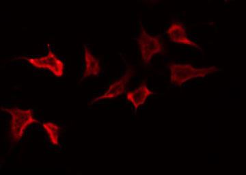 PTPRN2 / Phogrin Antibody - Staining NIH-3T3 cells by IF/ICC. The samples were fixed with PFA and permeabilized in 0.1% Triton X-100, then blocked in 10% serum for 45 min at 25°C. The primary antibody was diluted at 1:200 and incubated with the sample for 1 hour at 37°C. An Alexa Fluor 594 conjugated goat anti-rabbit IgG (H+L) Ab, diluted at 1/600, was used as the secondary antibody.