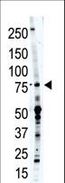 PTPRR Antibody - The anti-PCPTP1 antibody is used in Western blot to detect PCPTP1 in placenta tissue lysate.