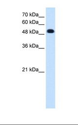 PTPRR Antibody - Jurkat cell lysate. Anti-PTPRR Antibody concentration: 0.25 ug/ml.  This image was taken for the unconjugated form of this product. Other forms have not been tested.