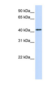 PTPRR Antibody - PTPRR antibody Western blot of Placenta lysate. This image was taken for the unconjugated form of this product. Other forms have not been tested.