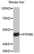 PTPRR Antibody - Western blot analysis of extracts of mouse liver, using PTPRR Antibody at 1:3000 dilution. The secondary antibody used was an HRP Goat Anti-Rabbit IgG (H+L) at 1:10000 dilution. Lysates were loaded 25ug per lane and 3% nonfat dry milk in TBST was used for blocking. An ECL Kit was used for detection and the exposure time was 90s.