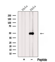 PTPRR Antibody - Western blot analysis of extracts of HeLa cells using PTPRR antibody. The lane on the left was treated with blocking peptide.