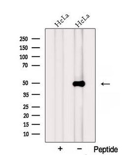 PTPRR Antibody - Western blot analysis of extracts of HeLa cells using PTPRR antibody. The lane on the left was treated with blocking peptide.