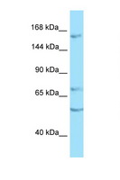 PTPRT Antibody - PTPRT antibody Western blot of COL0205 Cell lysate. Antibody concentration 1 ug/ml.  This image was taken for the unconjugated form of this product. Other forms have not been tested.