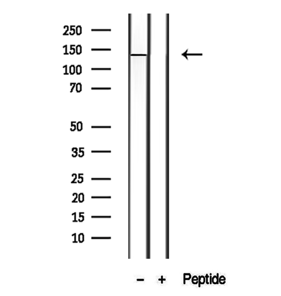 PTPRU Antibody - Western blot analysis of extracts of human liver tissue using PTPRO antibody.