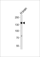 PTPRZ1 / Phosphacan Antibody - Western blot of lysate from human brain tissue lysate, using PTPRZ1 antibody diluted at 1:1000. A goat anti-rabbit IgG H&L (HRP) at 1:10000 dilution was used as the secondary antibody. Lysate at 20 ug.