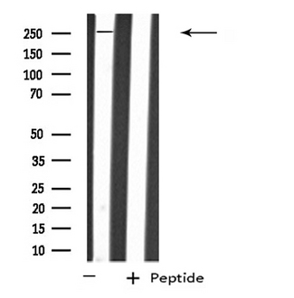 PTPRZ1 / Phosphacan Antibody - Western blot analysis of extracts of A549 cells using PTPRZ1 antibody.