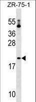 PTRH1 Antibody - PTRH1 Antibody western blot of ZR-75-1 cell line lysates (35 ug/lane). The PTRH1 antibody detected the PTRH1 protein (arrow).