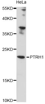 PTRH1 Antibody - Western blot analysis of extracts of HeLa cells, using PTRH1 antibody at 1:1000 dilution. The secondary antibody used was an HRP Goat Anti-Rabbit IgG (H+L) at 1:10000 dilution. Lysates were loaded 25ug per lane and 3% nonfat dry milk in TBST was used for blocking. An ECL Kit was used for detection and the exposure time was 90s.