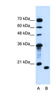 PTRH2 / BIT1 Antibody - PTRH2 antibody ARP44695_T100-NP_001015509-PTRH2(peptidyl-tRNA hydrolase 2) Antibody Western blot of Jurkat lysate.  This image was taken for the unconjugated form of this product. Other forms have not been tested.