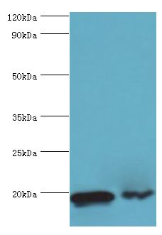 PTRH2 / BIT1 Antibody - Western blot. All lanes: Peptidyl-tRNA hydrolase 2, mitochondrial antibody at 4 ug/ml. Lane 1: MM231 whole cell lysate. Lane 2: Jurkat whole cell lysate. secondary Goat polyclonal to rabbit at 1:10000 dilution. Predicted band size: 19 kDa. Observed band size: 19 kDa.