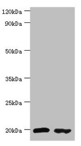 PTRH2 / BIT1 Antibody - Western blot All lanes: Peptidyl-tRNA hydrolase 2, mitochondrial antibody at 4µg/ml Lane 1: MM231 whole cell lysate Lane 2: Jurkat whole cell lysate Secondary Goat polyclonal to rabbit IgG at 1/10000 dilution Predicted band size: 19 kDa Observed band size: 19 kDa
