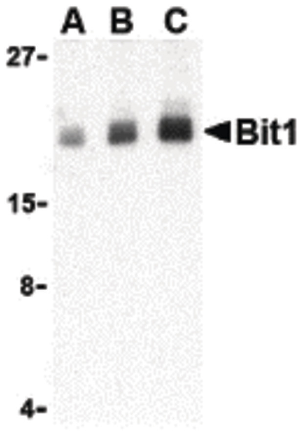 PTRH2 / BIT1 Antibody - Western blot of Bit1 in Daudi cell lysate with Bit1 antibody at (A) 1, (B) 2, and (C) 4 ug/ml.