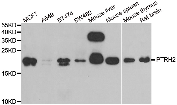 PTRH2 / BIT1 Antibody - Western blot analysis of extracts of various cell lines.
