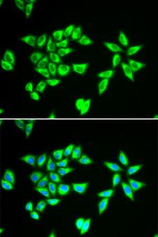 PTRH2 / BIT1 Antibody - Immunofluorescence analysis of MCF-7 cells.