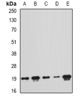 PTRH2 / BIT1 Antibody - Western blot analysis of PTRH2 expression in MCF7 (A); A549 (B); mouse liver (C); mouse spleen (D); rat brain (E) whole cell lysates.