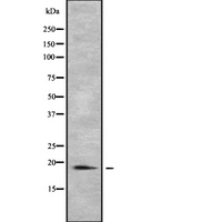PTRH2 / BIT1 Antibody - Western blot analysis of PTRH2 using COLO205 whole cells lysates