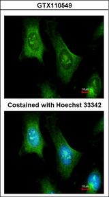 PTS Antibody - Immunofluorescence of methanol-fixed HeLa using PTS antibody at 1:100 dilution.