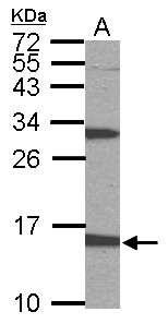 PTS Antibody - Sample (50 ug of whole cell lysate). A: mouse stomach. 15% SDS PAGE. PTS antibody diluted at 1:1000.