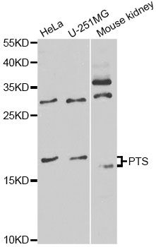 PTS Antibody - Western blot analysis of extracts of various cell lines, using PTS antibody at 1:1000 dilution. The secondary antibody used was an HRP Goat Anti-Rabbit IgG (H+L) at 1:10000 dilution. Lysates were loaded 25ug per lane and 3% nonfat dry milk in TBST was used for blocking. An ECL Kit was used for detection and the exposure time was 60s.
