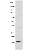 PTS Antibody - Western blot analysis of PTS using HuvEc whole cells lysates