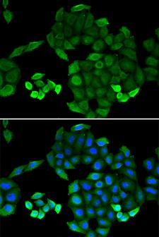 PTS Antibody - Immunofluorescence analysis of MCF-7 cells using PTS Polyclonal Antibody.