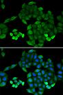 PTS Antibody - Immunofluorescence analysis of MCF-7 cells using PTS Polyclonal Antibody.