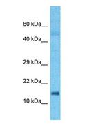 PTS Antibody - Western blot of PTPS Antibody with human large intestine Tumor lysate.  This image was taken for the unconjugated form of this product. Other forms have not been tested.