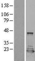 PTS Protein - Western validation with an anti-DDK antibody * L: Control HEK293 lysate R: Over-expression lysate