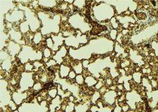 PTTG1IP / PBF Antibody - 1:100 staining mouse lung tissue by IHC-P. The sample was formaldehyde fixed and a heat mediated antigen retrieval step in citrate buffer was performed. The sample was then blocked and incubated with the antibody for 1.5 hours at 22°C. An HRP conjugated goat anti-rabbit antibody was used as the secondary.