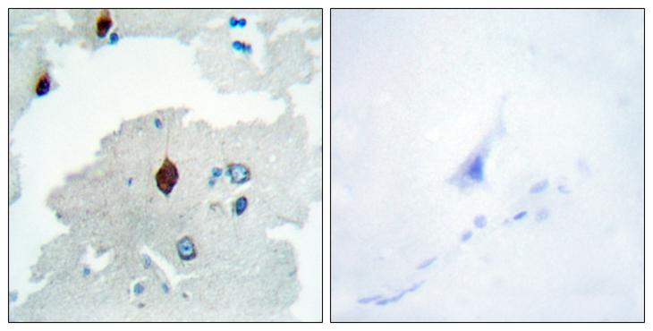 PTTG1IP / PBF Antibody - Peptide - + Immunohistochemistry analysis of paraffin-embedded human brain tissue using PTTG antibody.