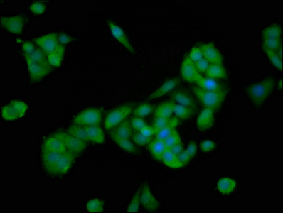 PTTG2 Antibody - Immunofluorescence staining of PC3 cells at a dilution of 1:166, counter-stained with DAPI. The cells were fixed in 4% formaldehyde, permeabilized using 0.2% Triton X-100 and blocked in 10% normal Goat Serum. The cells were then incubated with the antibody overnight at 4 °C.The secondary antibody was Alexa Fluor 488-congugated AffiniPure Goat Anti-Rabbit IgG (H+L) .
