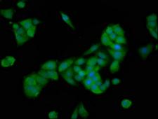 PTTG2 Antibody - Immunofluorescence staining of PC3 cells at a dilution of 1:166, counter-stained with DAPI. The cells were fixed in 4% formaldehyde, permeabilized using 0.2% Triton X-100 and blocked in 10% normal Goat Serum. The cells were then incubated with the antibody overnight at 4 °C.The secondary antibody was Alexa Fluor 488-congugated AffiniPure Goat Anti-Rabbit IgG (H+L) .