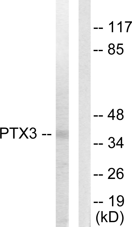 PTX3 / Pentraxin 3 Antibody - Western blot analysis of lysates from 293 cells, using PTX3 Antibody. The lane on the right is blocked with the synthesized peptide.