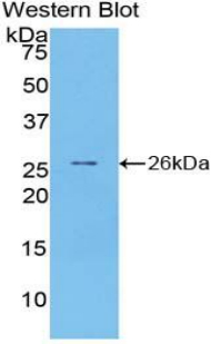 PTX3 / Pentraxin 3 Antibody - Western blot of recombinant Pentraxin 3 / PTX3.  This image was taken for the unconjugated form of this product. Other forms have not been tested.