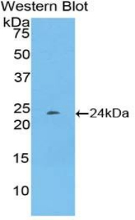 PTX3 / Pentraxin 3 Antibody - Western blot of recombinant Pentraxin 3 / PTX3.  This image was taken for the unconjugated form of this product. Other forms have not been tested.