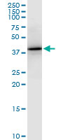PTX3 / Pentraxin 3 Antibody - PTX3 monoclonal antibody (M01), clone 5B7. Western Blot analysis of PTX3 expression in PC-12.